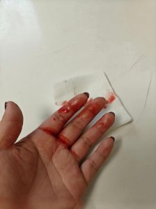 风水手流血是坏事吗