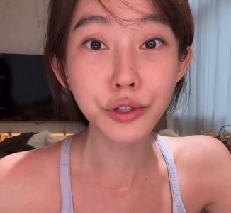 冯提莫直播承认整容！自嘲“像被菜刀割过”