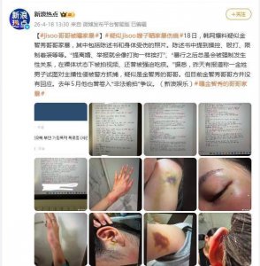 韩星金智秀哥哥被曝家暴，疑似24岁妻子发文控诉，晒家暴伤痕