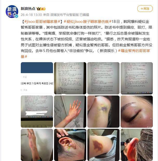 韩星金智秀哥哥被曝家暴，疑似24岁妻子发文控诉，晒家暴伤痕