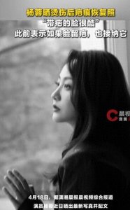 演员杨蓉晒烫伤后疤痕恢复照，称“带疤的脸很酷”
