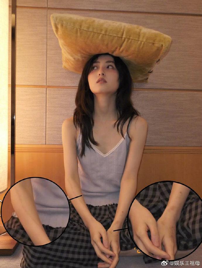 张子枫晒素颜自拍照,网友发现张子枫手臂都是伤疤