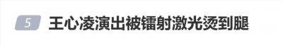 王心凌演出被镭射激光烫到腿，本人痛到发出尖叫，主办方发致歉信