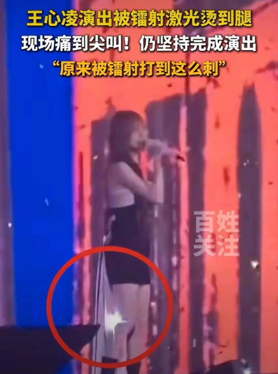 王心凌演唱会被激光烫伤,强忍疼痛完成演出,主办方道歉敷衍惹众怒